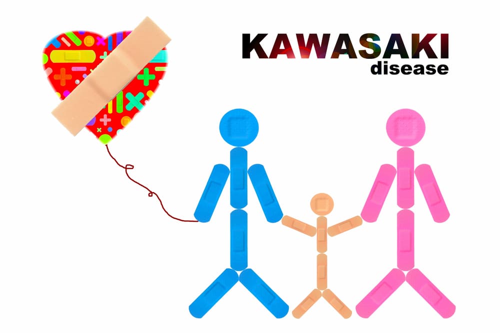 ALLA SCOPERTA DI UNA MALATTIA RARA: LA SINDROME DI KAWASAKI