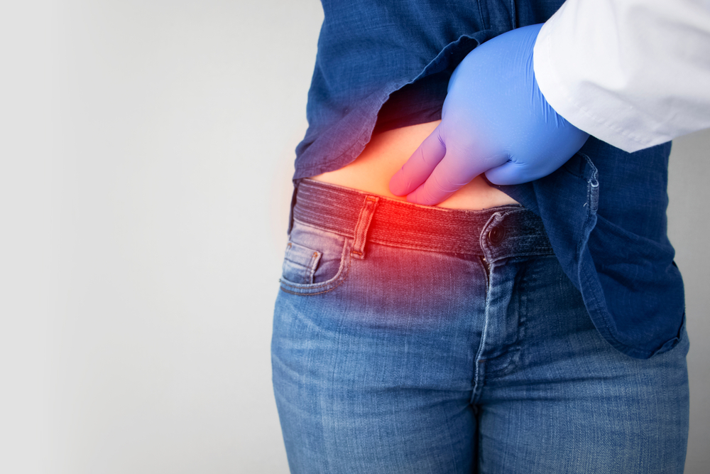 I FALSI MITI DEI DIVERTICOLI