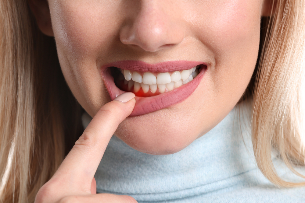 COME IL DENTISTA PUÒ RICONOSCERE UN DIABETICO?