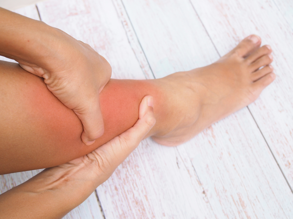 GAMBE GONFIE E PESANTI? ECCO I 3 CONSIGLI DA SEGUIRE