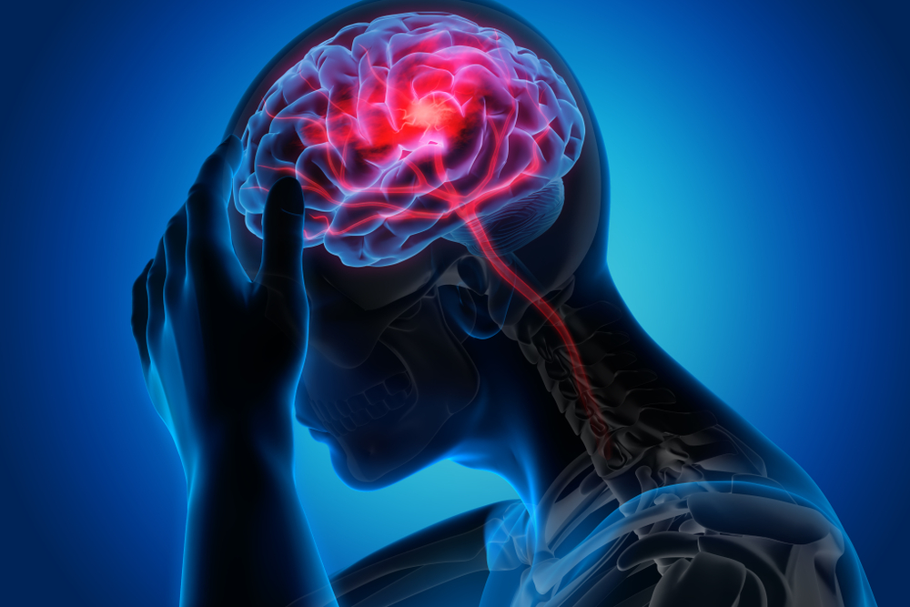 7 MODI PER PREVENIRE IL RISCHIO DI ICTUS