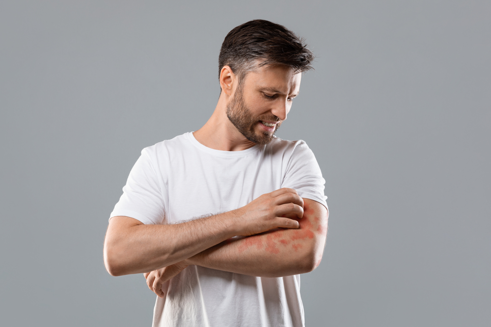 PSORIASI E SALUTE MENTALE, IL LEGAME