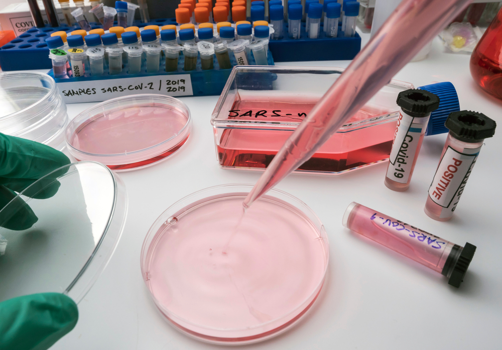 SARS-COV-2: NUOVO TEST SU SANGUE PER LA VALUTAZIONE DELLA RISPOSTA IMMUNITARIA