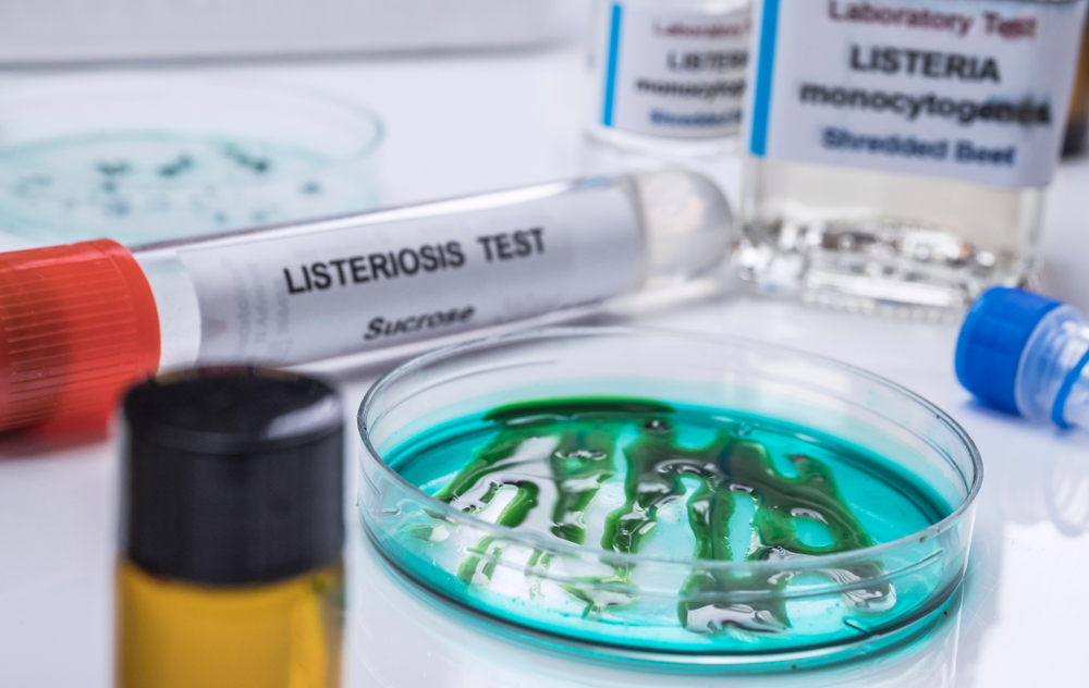 LA LISTEROSI: COS’È E COME PREVENIRLA