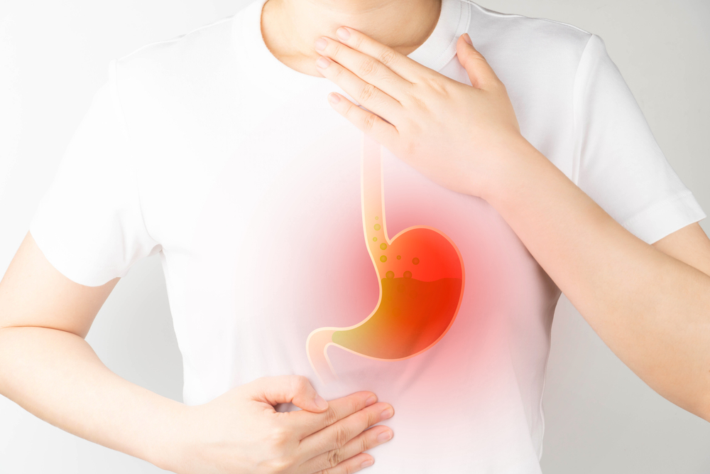 LE CAUSE DEL REFLUSSO GASTROESOFAGEO