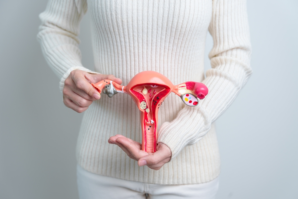 Sconfiggere l’endometriosi con il laser