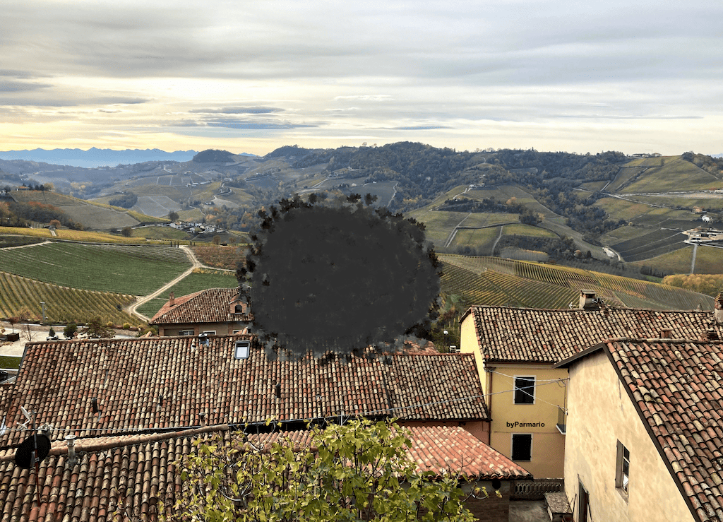 Maculopatia Senile: La Sfida del Futuro