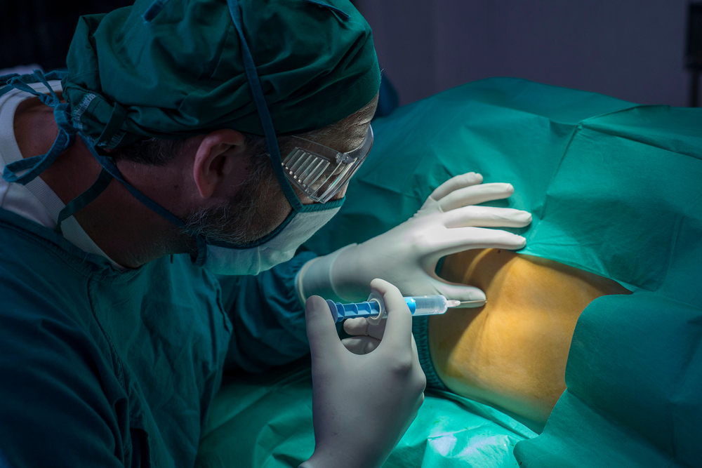 Anestesia e sedazione