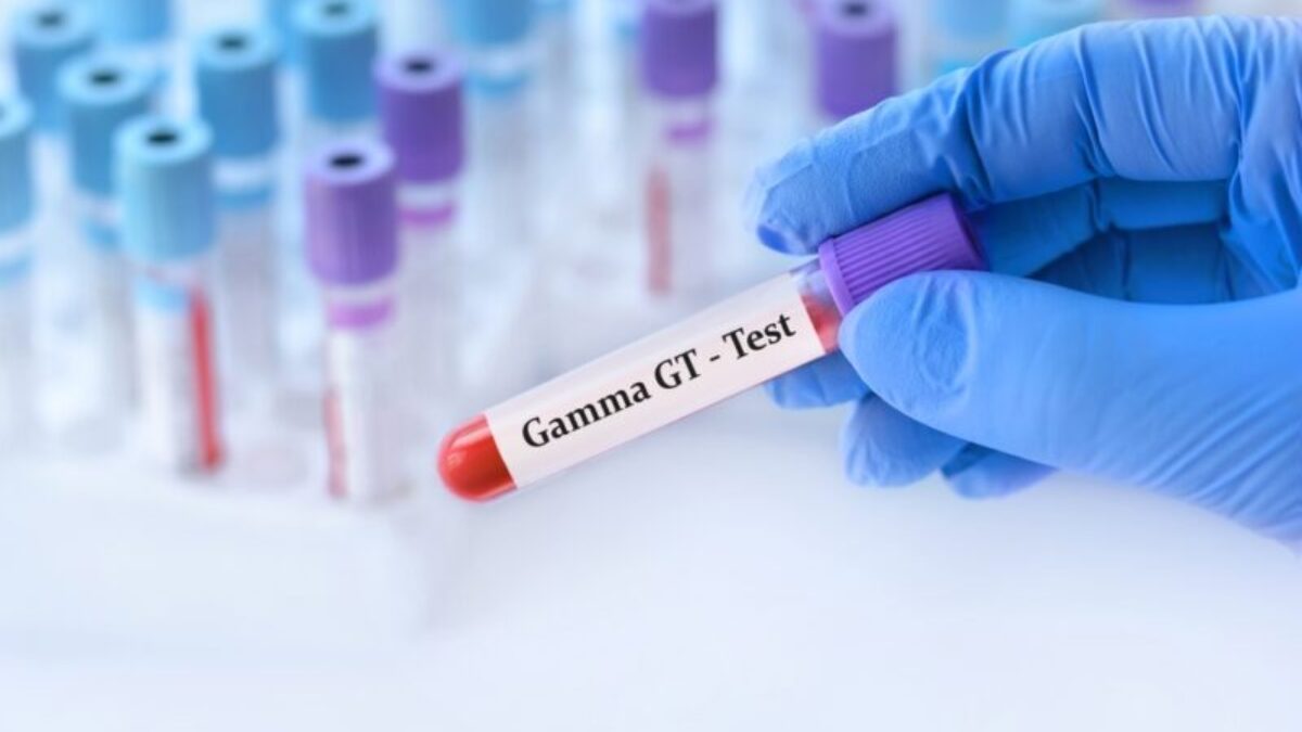 GammaGT