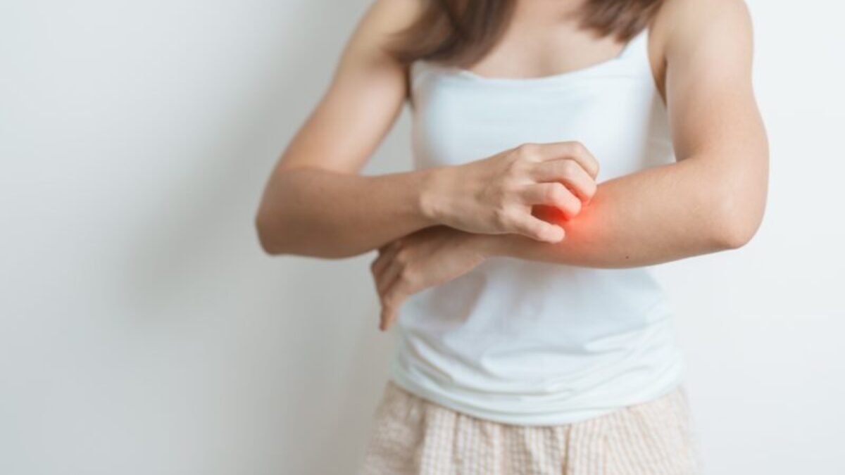 Lupus Eritematoso Sistemico assistenza
